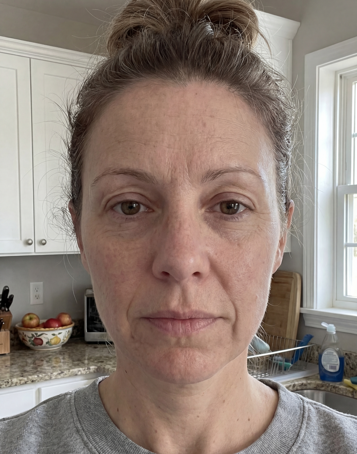 Before transformation